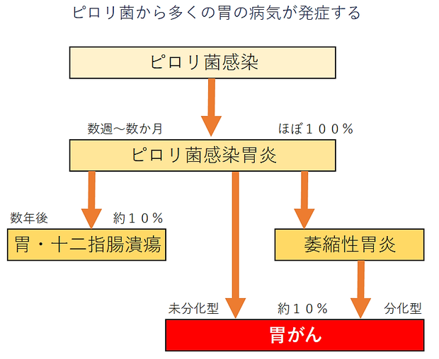 ピロリ菌が原因で様々な胃の疾病が